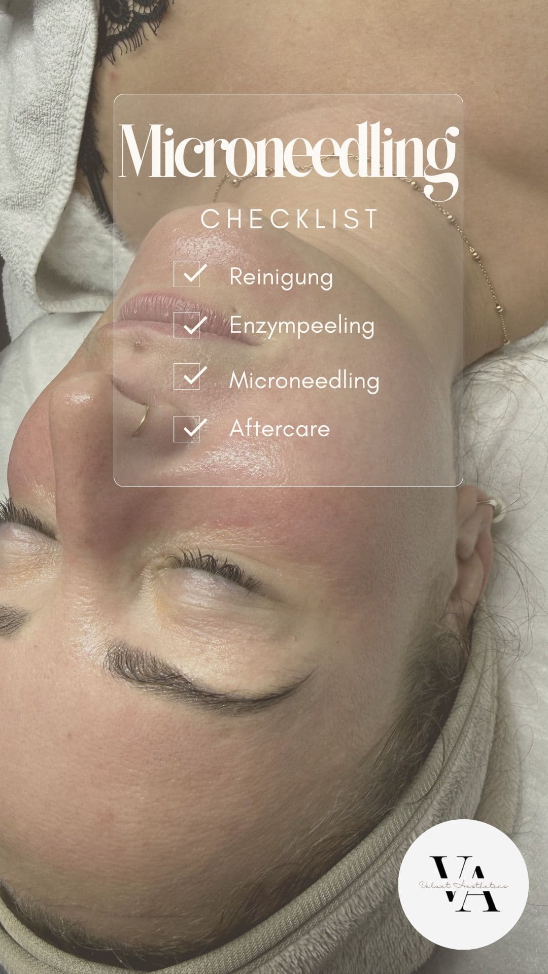 Aquafacial Behandlung bei Velvet Aesthetics